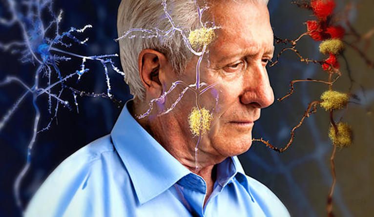 Физичка активност успорава Алцхајмерову болест 1